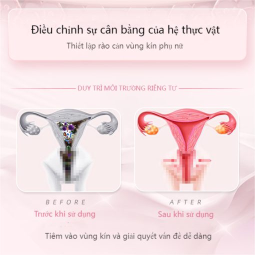 tiện lợi。Gel vệ sinh phụ nữ