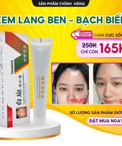 Kem Lang Ben TIANGE Hỗ Trợ Dứt Điểm Lang Ben